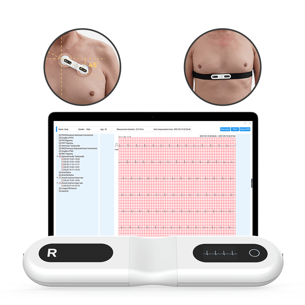 Wellue ECG Recorder met scherm