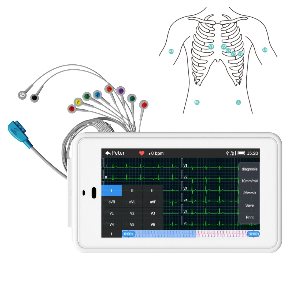 Wellue 12-Lead Pocket ECG